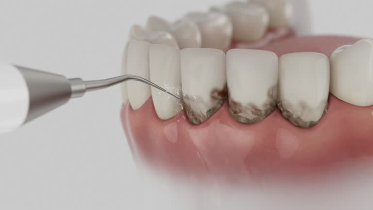 Reliable Dental Implants contractor in Nanticoke, PA by Smile Center Dentistry